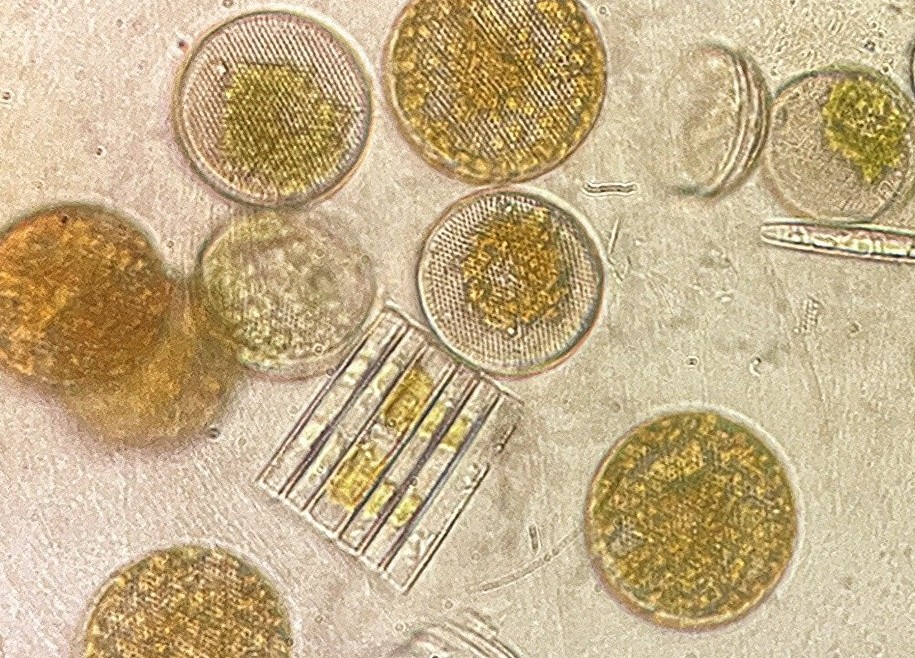 300Articles_Phytoplankton_credit Pauline Latour Phytoplankton | Image Credit: Pauline Latour