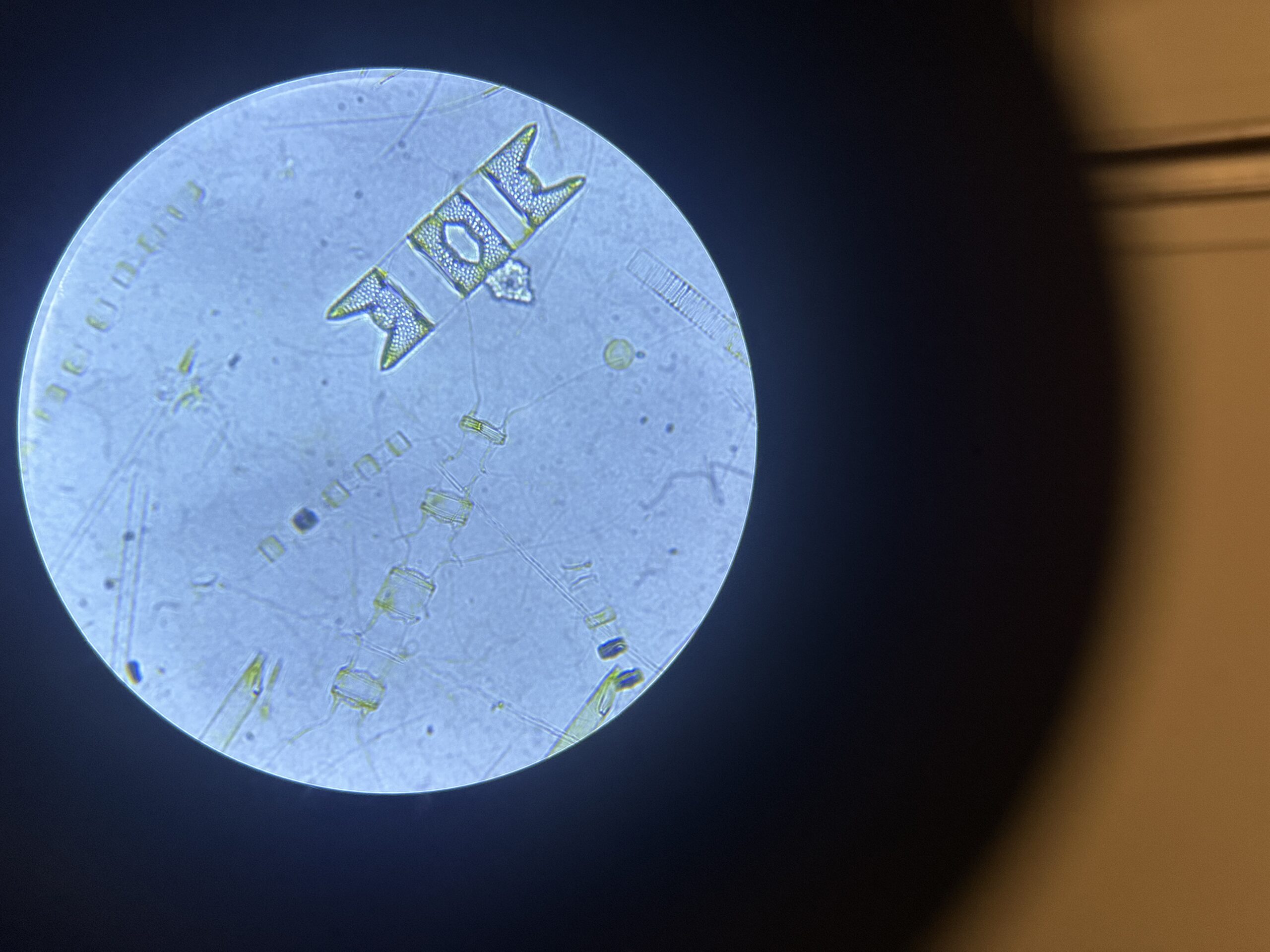 Microscopic Antarctic phytoplankton form the base of the marine food web | Image credit: Rachel Meyne