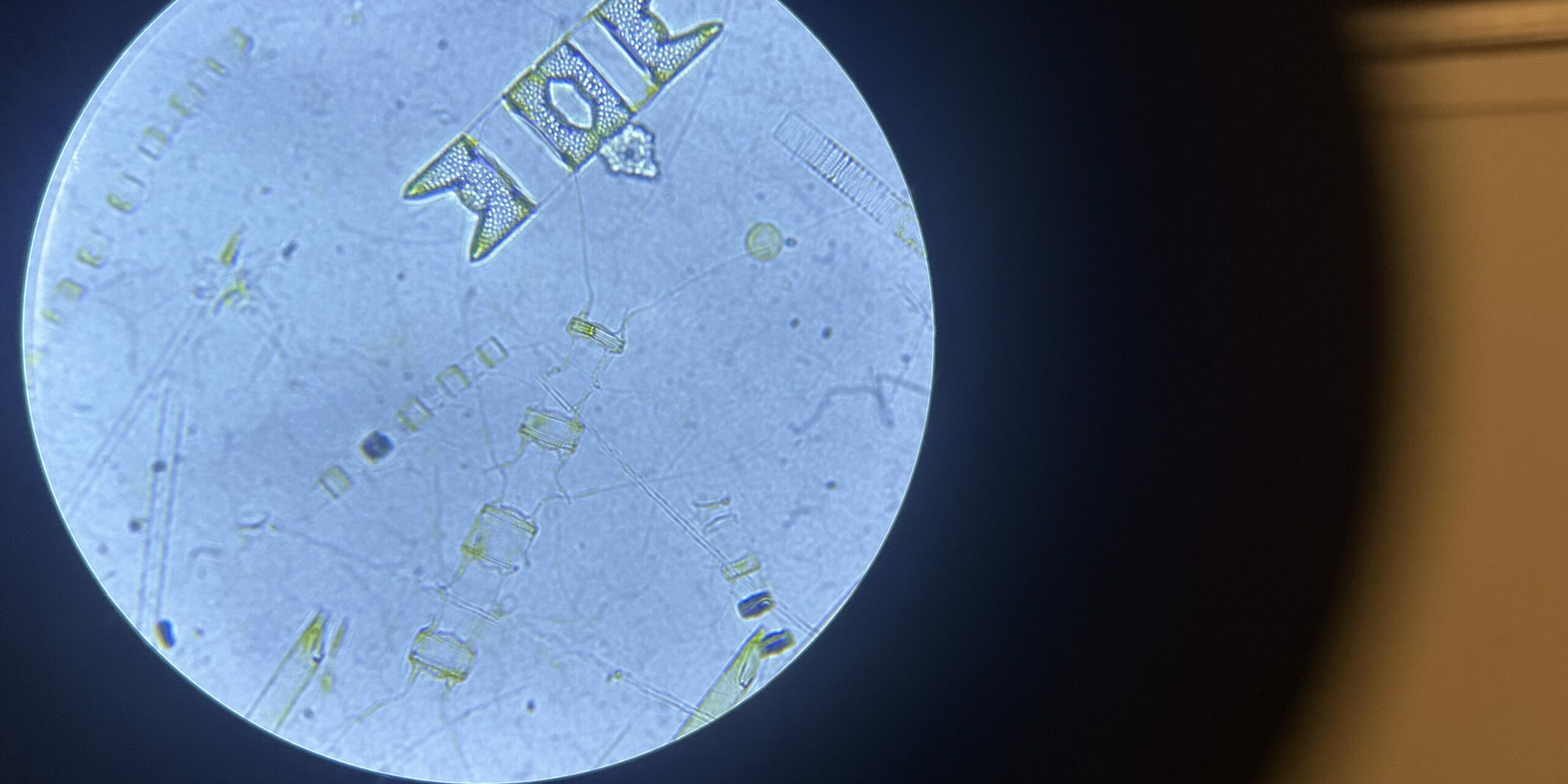 Microscopic Antarctic phytoplankton form the base of the marine food web | Image credit: Rachel Meyne