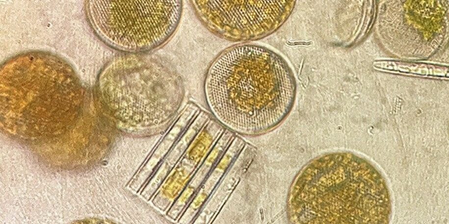 Phytoplankton | Image Credit: Pauline Latour